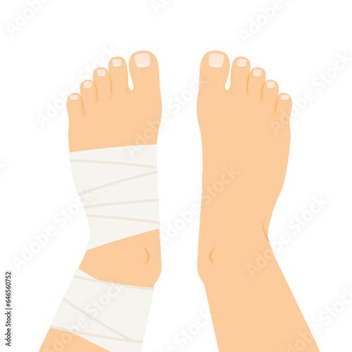 compression bandage wrapped around the twisted ankle- vector illustration