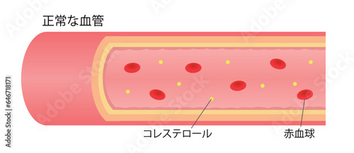 動脈硬化がない正常な血管の横断面図のイラスト