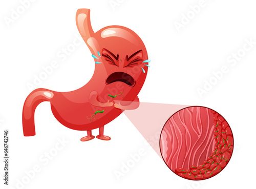 Crying cartoon stomach character with helicobacter pylori infection in epithelial cells under magnification