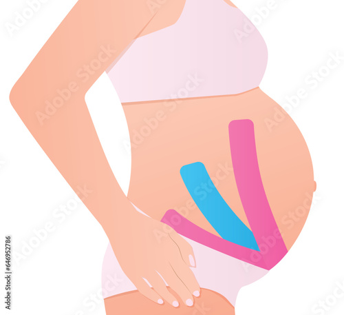 kinesio taping on pregnant woman -vector illustration