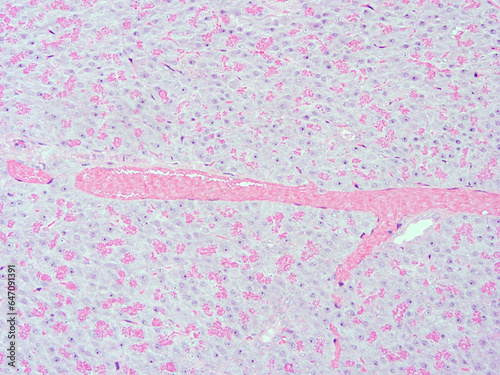 picture of histology human tissue with microscope from laboratory (not Illustration Designation)