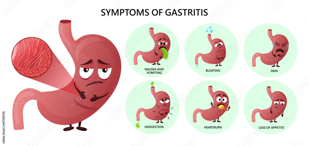 Gastritis Symptoms Infographic With Cartoon Stomach Characters Stock