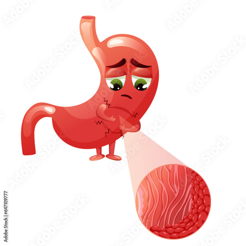 Sad cartoon stomach character with gastritis, inflammation in epithelial cells under magnification