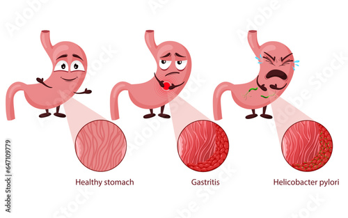 Stomach gastritis and helicobacter pylori illustration photo