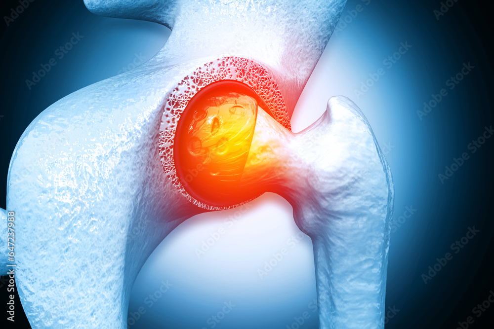 Bones of the pelvis and hip, human anatomy, femur bone joint pain, X ray of the hip joint and
