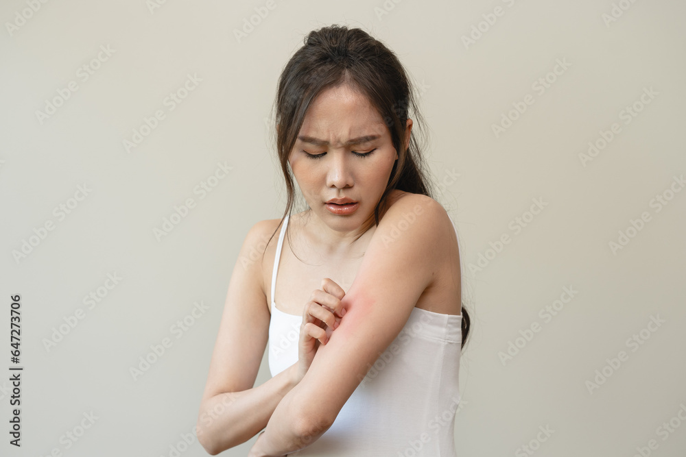 Dermatology, asian young woman reaction from atopic, insect bites on her arm, hand in scratching itchy red spot or rash of skin. Healthcare, treatment of beauty. Dermatology, asian young woman reaction from atopic, insect bites on her arm, hand in scratching itchy red spot or rash of skin. Healthcare, treatment of beauty.
