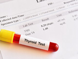 Blood sample tube with abnormal thyroid hormone test result