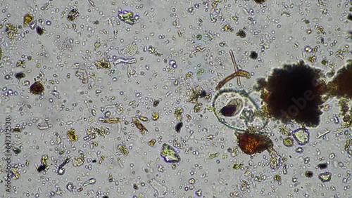 soil microorganisms close up under the microscope. in a soil samlple from a farm photo