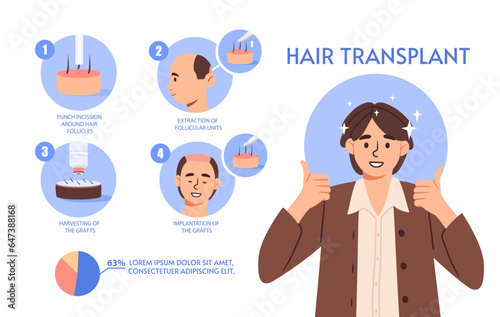 Hair transplant infographic concept. Medical education materials. Man transplanted his hair. Beauty and aesthetics. Treatment of alopecia and hairloss. Cartoon flat vector illustration