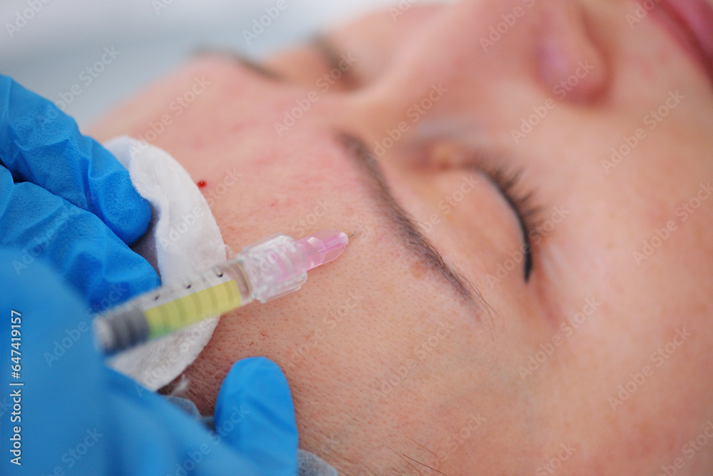 cosmetologist injects an injection of his own platelet-rich blood plasma under the patient's skin. Mesotherapy, biorevitalization. cosmetologist injects an injection of his own platelet-rich blood plasma under the patient's skin. Mesotherapy, biorevitalization.