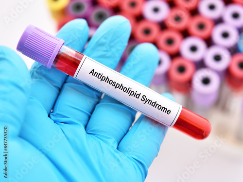 Blood sample tube for antiphospholipid syndrome (APS) test, diagnosis for autoimmune disease