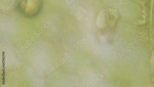 Through layers of microkomos. Ocean Algae under a microscope