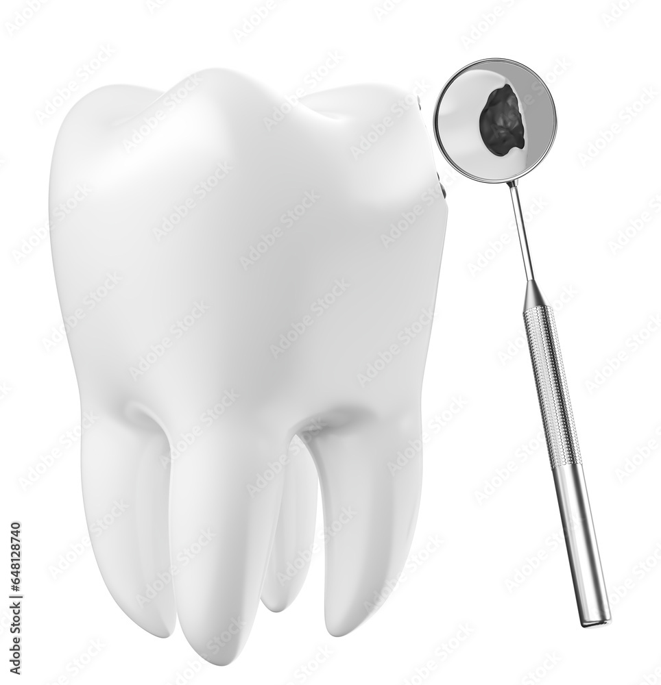 Tooth with caries in on transparent background in 3d render Stock ...