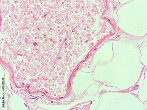 picture of histology human tissue with microscope from laboratory (not Illustration Designation)
