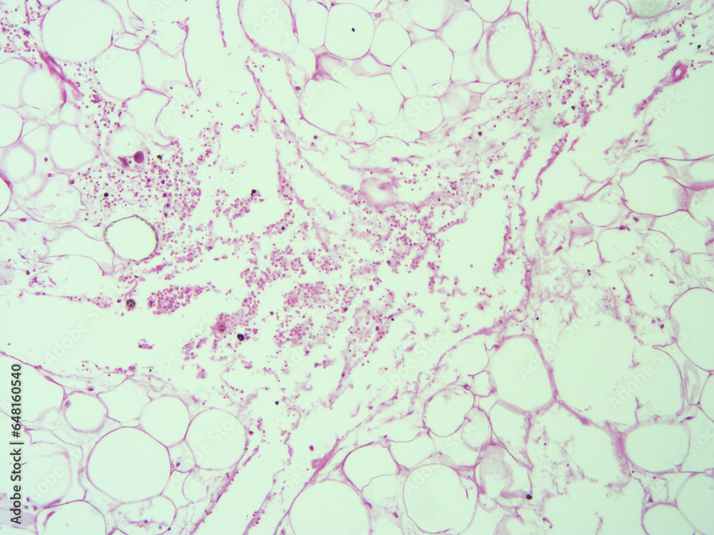 picture of histology human tissue with microscope from laboratory (not Illustration Designation) picture of histology human tissue with microscope from laboratory (not Illustration Designation)