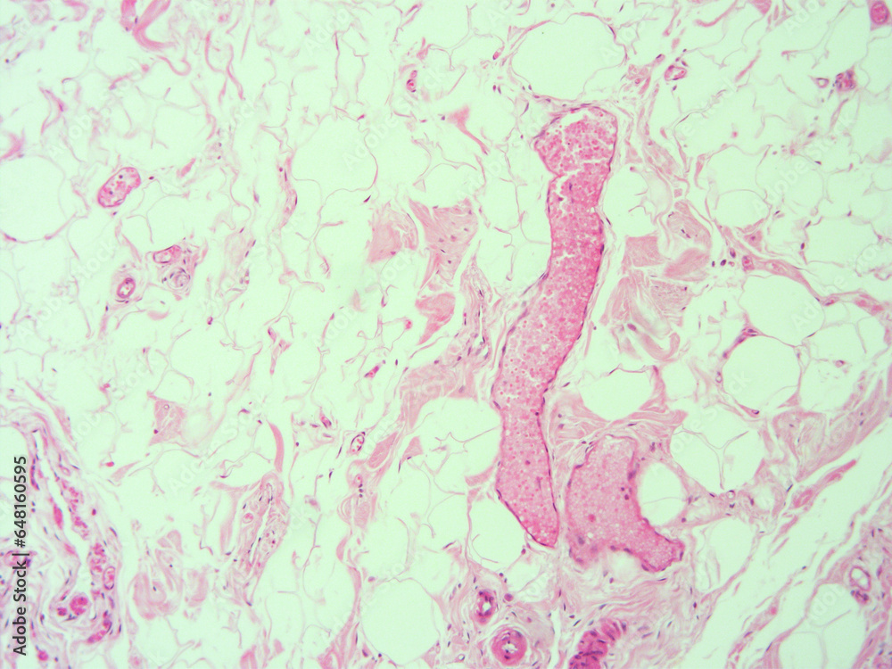 picture of histology human tissue with microscope from laboratory (not Illustration Designation)