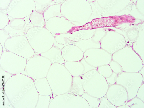 picture of histology human tissue with microscope from laboratory (not Illustration Designation)