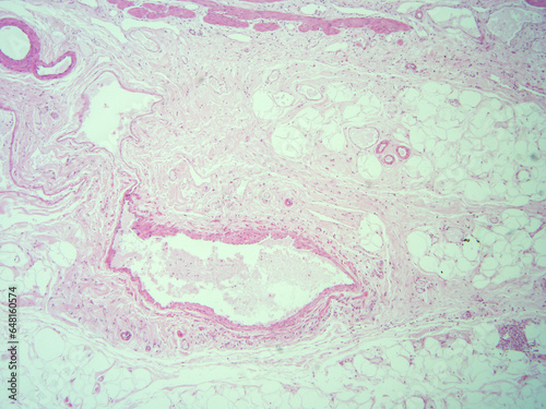 picture of histology human tissue with microscope from laboratory (not Illustration Designation)