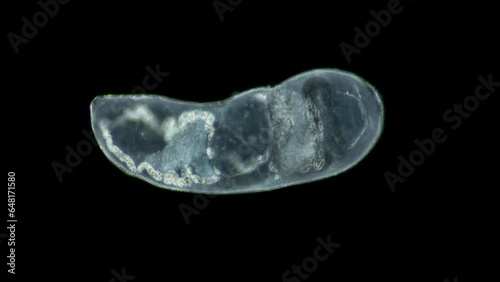 Parasitic Trematoda worm under microscope, possibly Brachyphallus crenatus. Stage of development of mature larva is Metacercaria. White sea photo