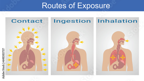 Vector Illustration for Routes of Exposure