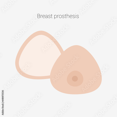 Breast prosthesis. Breast prosthesis for breast cancer patient after mastectomy. Vector illustration.