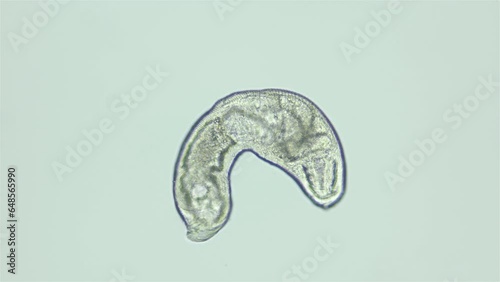 Parasitic Trematoda worm under microscope, possibly Brachyphallus crenatus. Stage of development of mature larva is Metacercaria. White sea photo