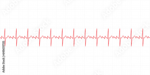 Electrocardiography heartbeat line monitor. Ecg