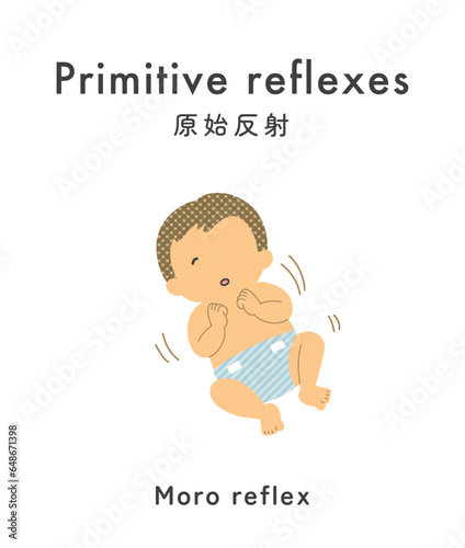 Illustration material: Primitive reflex_baby_
startle reflex