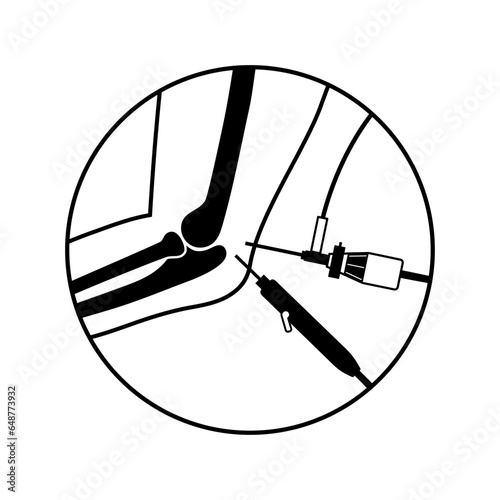 Elbow arthroscopy surgery