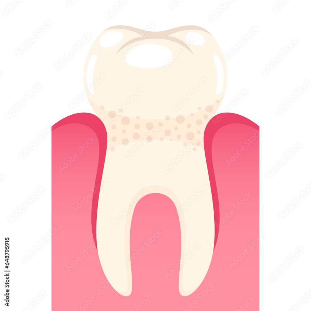 Vector strong tooth in gum on white background Vector strong tooth in gum on white background
