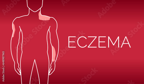 Red Eczema Background Illustration Design