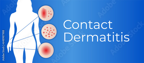 Contact Dermatitis Background Illustration