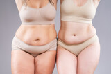 Tummy tuck, two fat women with flabby bellies on gray background, plastic surgery and body positive concept