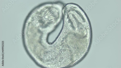Parasitic Trematoda worm under microscope, possibly Brachyphallus crenatus. Stage of development of mature larva is Metacercaria. White sea photo