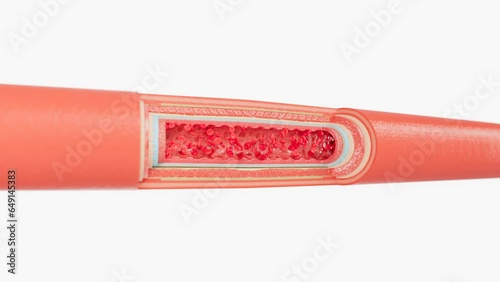 slice of Arter layers that Red blood cells flow inside that carry oxygen nutrien from heart to cells.
artery layers : outer layer,smooth muscle, elastic layer,inner layer photo