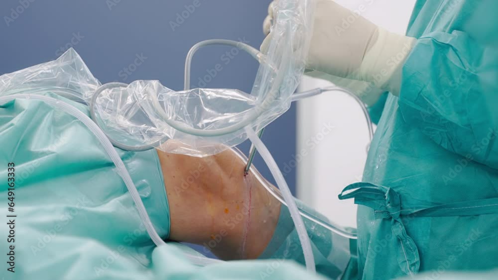 Professional Surgeon Performing Arthroscopic Knee Surgery close up