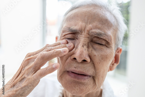 Foto Senior woman with Allergic Conjunctivitis,Viral Blepharitis,eye inflection,elder