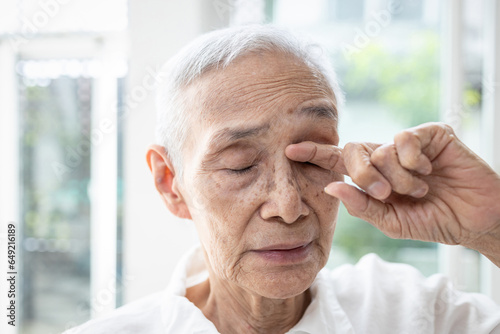 Old elderly rubbing her eye,dry eyes,irritation,redness and itching,senior suffer from senile cataract,eye-related diseases,blurred clouded vision or double vision,sensitive to bright lights and glare photo