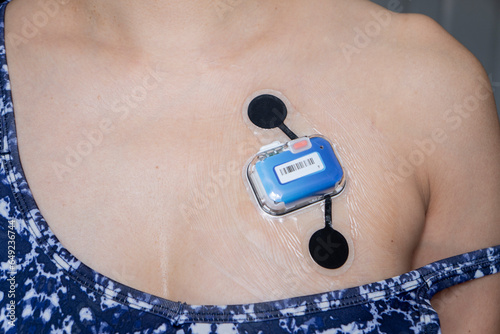 oung woman with heart electrocardiogram or monitoring using Holster for young patient. Cardiology. ECG sensors - electrocardiogram and blood pressure measurement.