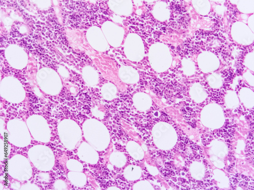 picture of histology human tissue with microscope from laboratory  not Illustration Designation 