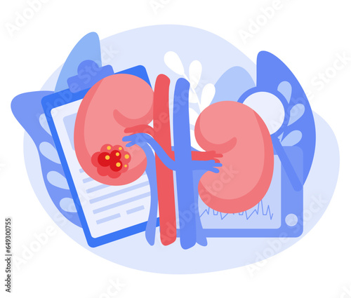 Concept of kidney cancer. Check your kidney health. Vector illustration