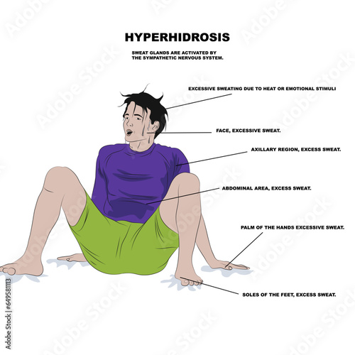 hyperhidrosis, increased sweating in certain areas of the body, resulting from an increase in the secretion of sweat glands.