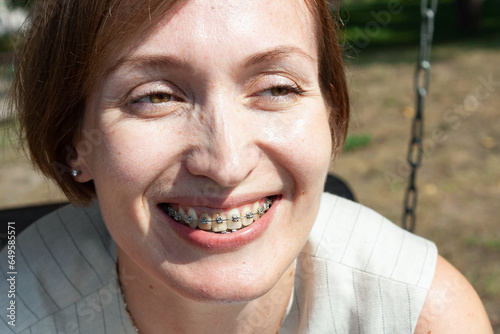 woman 30-35 years old, wearing braces, smiling, close-up, positi photo