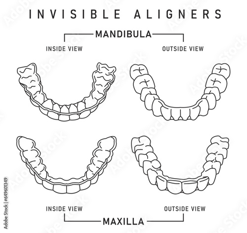 Orthodontic silicone trainer. Invisible braces aligner, retainer.