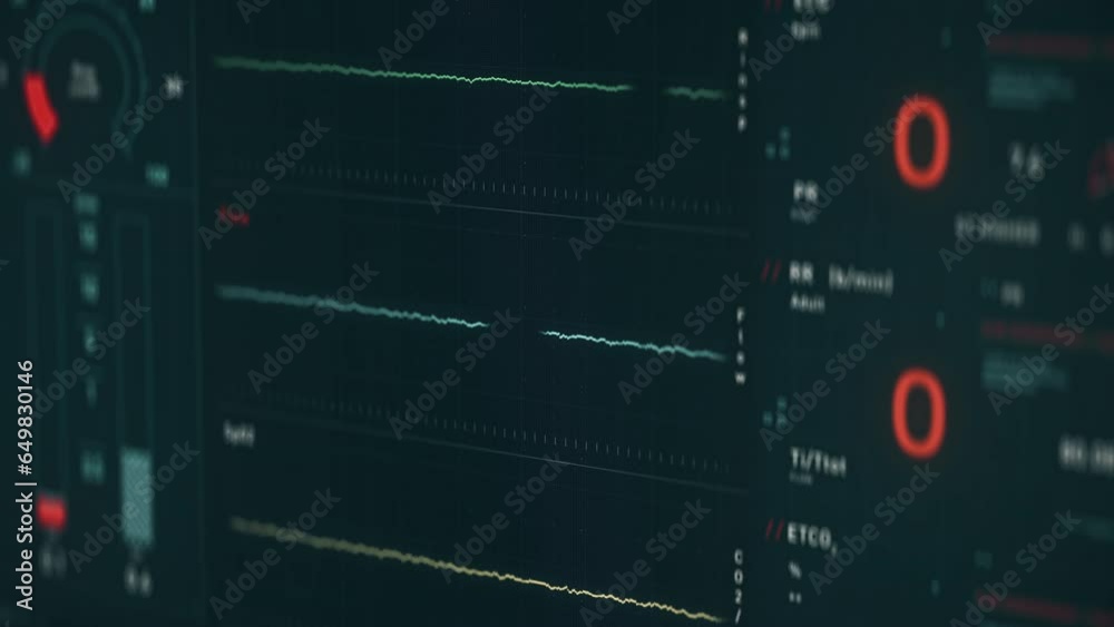 Monitoring the vital signs of the patients health on the display. Medical system displaying the vital life signs. Monitor displaying the sudden failure of sick persons vital health signs. Alert. Monitoring the vital signs of the patients health on the display. Medical system displaying the vital life signs. Monitor displaying the sudden failure of sick persons vital health signs. Alert.