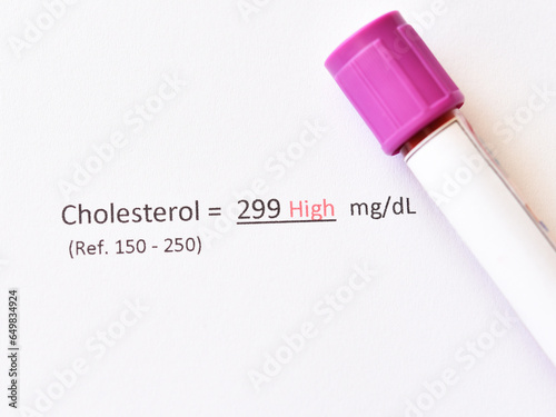 Blood sample tube with abnormal high cholesterol test result photo