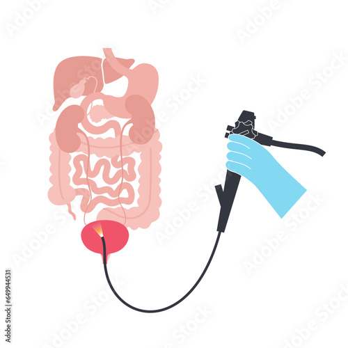 Cystoscopy examination concept