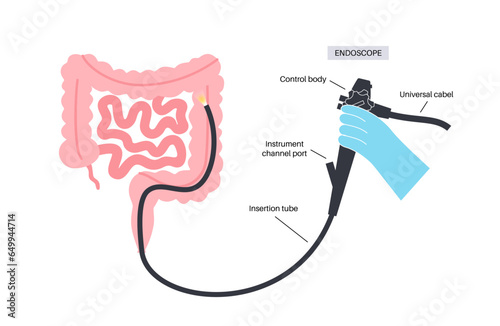 Colonoscopy medical procedure