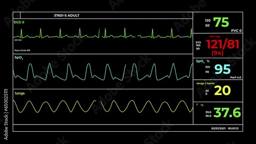 CGI video of screen of medical equipment with integrated systems of monitoring vital parameters photo