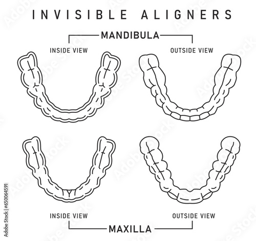 Orthodontic silicone trainer. Invisible braces aligner, retainer.